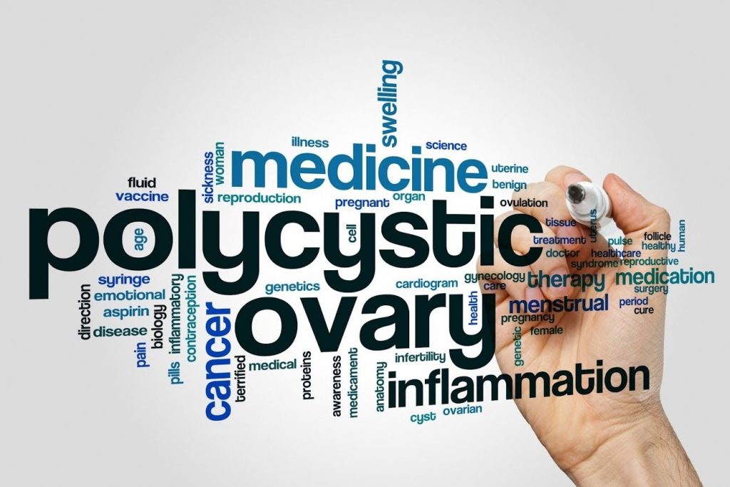 Polycystic Ovary Syndrome or PCOS 