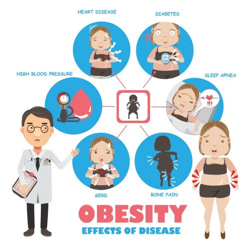 Obesity Putting Us At Risk of Cancer